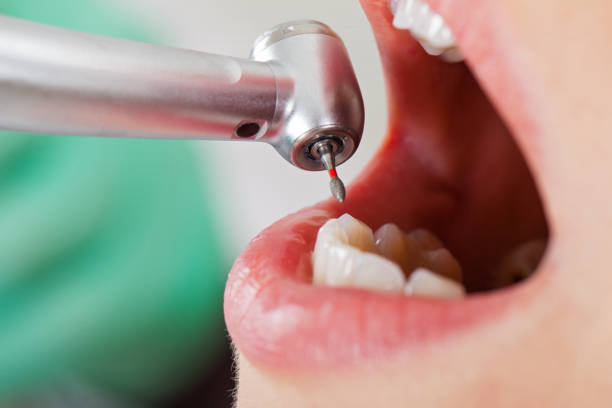 Best Urgent Care for Lost Fillings or Crowns in Highland Falls, NY